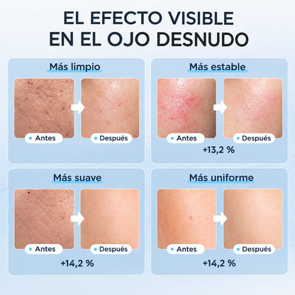 Máscara facial LED con Terapia de Luz Roja para la Cara y la Piel